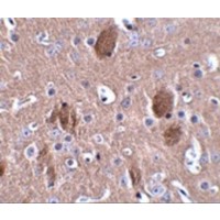 C16orf5 / I1 Antibody - Immunohistochemistry of CDIP in mouse brain tissue with CDIP antibody at 2.5 µg/mL.