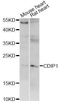 C16orf5 / I1 Antibody - Western blot analysis of extracts of various cell lines, using CDIP1 antibody at 1:1000 dilution. The secondary antibody used was an HRP Goat Anti-Rabbit IgG (H+L) at 1:10000 dilution. Lysates were loaded 25ug per lane and 3% nonfat dry milk in TBST was used for blocking. An ECL Kit was used for detection and the exposure time was 5s.