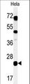 C16orf54 Antibody - Western blot of CP054 Antibody in HeLa cell line lysates (35 ug/lane). CP054 (arrow) was detected using the purified antibody.