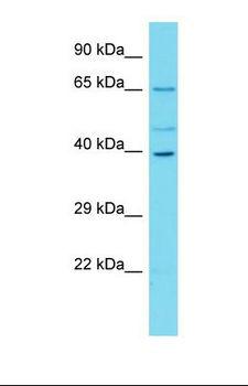 C16orf59 Antibody - Western blot of Human Hela. C16orf59 antibody dilution 1.0 ug/ml.  This image was taken for the unconjugated form of this product. Other forms have not been tested.