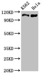 C16orf62 Antibody - Western Blot Positive WB detected in: K562 whole cell lysate, Hela whole cell lysate All lanes: C16orf62 antibody at 3µg/ml Secondary Goat polyclonal to rabbit IgG at 1/50000 dilution Predicted band size: 110, 94 kDa Observed band size: 110 kDa