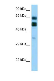 C16orf70 / LIN10 Antibody - C16orf70 antibody Western blot of Placenta lysate. Antibody concentration 1 ug/ml.  This image was taken for the unconjugated form of this product. Other forms have not been tested.