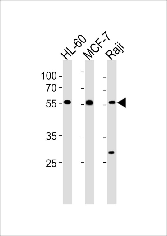 C16orf71 Antibody - C16orf71 Antibody western blot of HL-60,MCF-7 and Raji cell line lysates (35 ug/lane). The C16orf71 antibody detected the C16orf71 protein (arrow).