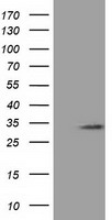 C16orf72 Antibody - HEK293T cells were transfected with the pCMV6-ENTRY control (Left lane) or pCMV6-ENTRY C16orf72 (Right lane) cDNA for 48 hrs and lysed. Equivalent amounts of cell lysates (5 ug per lane) were separated by SDS-PAGE and immunoblotted with anti-C16orf72.