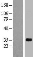 C16orf72 Protein - Western validation with an anti-DDK antibody * L: Control HEK293 lysate R: Over-expression lysate