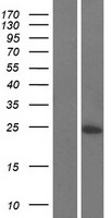 C16orf74 Protein - Western validation with an anti-DDK antibody * L: Control HEK293 lysate R: Over-expression lysate