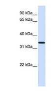 C16orf78 Antibody - C16orf78 antibody Western blot of Fetal Lung lysate. This image was taken for the unconjugated form of this product. Other forms have not been tested.