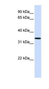 C16orf78 Antibody - C16orf78 antibody Western blot of Fetal Lung lysate. This image was taken for the unconjugated form of this product. Other forms have not been tested.