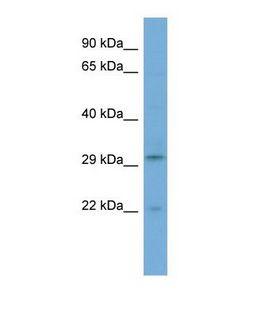 C16orf78 Antibody - Western blot of Human HeLa. C16orf78 antibody dilution 1.0 ug/ml.  This image was taken for the unconjugated form of this product. Other forms have not been tested.