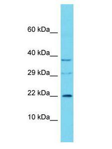 C16orf90 Antibody - C16orf90 antibody Western Blot of 721_B. Antibody dilution: 1 ug/ml.  This image was taken for the unconjugated form of this product. Other forms have not been tested.