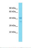 C16orf93 Antibody - Western blot of Human 721_B. C16orf93 antibody dilution 1.0 ug/ml.  This image was taken for the unconjugated form of this product. Other forms have not been tested.