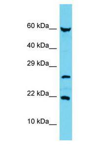 C17orf102 Antibody - C17orf102 antibody Western Blot of MCF7. Antibody dilution: 1 ug/ml.  This image was taken for the unconjugated form of this product. Other forms have not been tested.