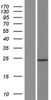 C17orf105 Protein - Western validation with an anti-DDK antibody * L: Control HEK293 lysate R: Over-expression lysate