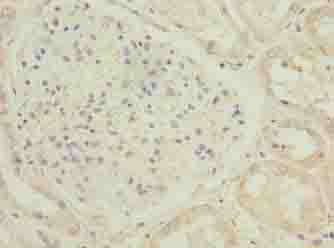 C17orf47 Antibody - Immunohistochemistry of paraffin-embedded human kidney tissue using antibody at dilution of 1:100.