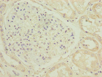 C17orf47 Antibody - Immunohistochemistry of paraffin-embedded human kidney tissue using C17orf47 Antibody at dilution of 1:100