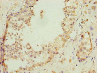 C17orf47 Antibody - Immunohistochemistry of paraffin-embedded human testis tissue using C17orf47 Antibody at dilution of 1:100