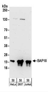 C17orf49 Antibody - Detection of Human BAP18 by Western Blot. Samples: Whole cell lysate (50 ug) from HeLa, 293T, and Jurkat cells. Antibodies: Affinity purified rabbit anti-BAP18 antibody used for WB at 0.1 ug/ml. Detection: Chemiluminescence with an exposure time of 3 minutes.