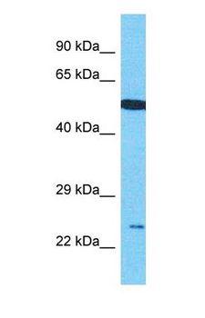 C17orf51 Antibody - Western blot of C17orf51 Antibody with human 721_B Whole Cell lysate.  This image was taken for the unconjugated form of this product. Other forms have not been tested.