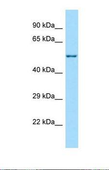C17orf53 Antibody - Western blot of Human MCF7. C17orf53 antibody dilution 1.0 ug/ml.  This image was taken for the unconjugated form of this product. Other forms have not been tested.