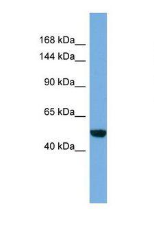 C17orf57 Antibody - Western blot of Human HT1080. EFCAB13 antibody dilution 1.0 ug/ml.  This image was taken for the unconjugated form of this product. Other forms have not been tested.