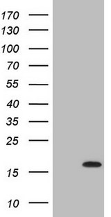 C17orf58 Antibody - HEK293T cells were transfected with the pCMV6-ENTRY control. (Left lane) or pCMV6-ENTRY C17orf58. (Right lane) cDNA for 48 hrs and lysed. Equivalent amounts of cell lysates. (5 ug per lane) were separated by SDS-PAGE and immunoblotted with anti-C17orf58. (1:2000)