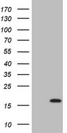 C17orf58 Antibody - HEK293T cells were transfected with the pCMV6-ENTRY control. (Left lane) or pCMV6-ENTRY C17orf58. (Right lane) cDNA for 48 hrs and lysed. Equivalent amounts of cell lysates. (5 ug per lane) were separated by SDS-PAGE and immunoblotted with anti-C17orf58. (1:2000)