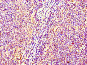 C17orf58 Antibody - Immunohistochemistry of paraffin-embedded human lymph node tissue using C17orf58 Antibody at dilution of 1:100