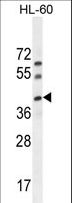 C17orf59 Antibody - C17orf59 Antibody western blot of HL-60 cell line lysates (35 ug/lane). The C17orf59 antibody detected the C17orf59 protein (arrow).