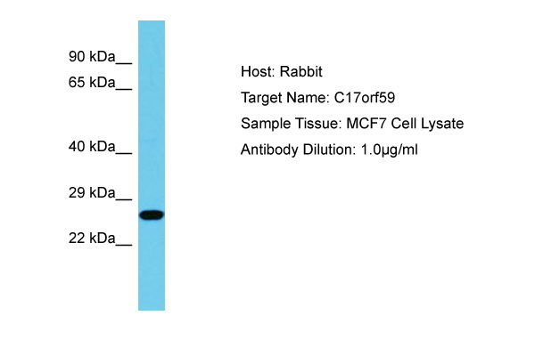 C17orf59 Antibody -  This image was taken for the unconjugated form of this product. Other forms have not been tested.
