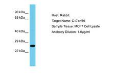 C17orf59 Antibody -  This image was taken for the unconjugated form of this product. Other forms have not been tested.