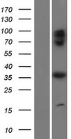 C17orf59 Protein - Western validation with an anti-DDK antibody * L: Control HEK293 lysate R: Over-expression lysate