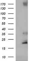 C17orf62 Antibody - HEK293T cells were transfected with the pCMV6-ENTRY control (Left lane) or pCMV6-ENTRY C17orf62 (Right lane) cDNA for 48 hrs and lysed. Equivalent amounts of cell lysates (5 ug per lane) were separated by SDS-PAGE and immunoblotted with anti-C17orf62.