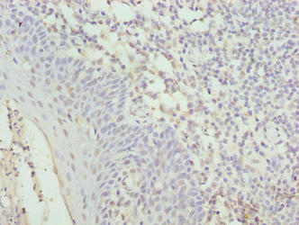 C17orf62 Antibody - Immunohistochemistry of paraffin-embedded human tonsil tissue using CYBC1 Antibody at dilution of 1:100