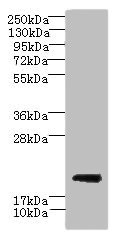 C17orf62 Antibody - Western blot All lanes: CYBC1 antibody at 1.5µg/ml + Mouse liver tissue Secondary Goat polyclonal to rabbit IgG at 1/10000 dilution Predicted band size: 21, 20 kDa Observed band size: 21 kDa
