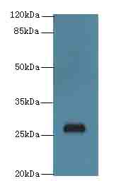 C17orf64 Antibody - Western blot. All lanes: C17orf64 antibody at 4 ug/ml+Mos- gonadal tissue Goat polyclonal to rabbit at 1:10000 dilution. Predicted band size: 27 kDa. Observed band size: 27 kDa.