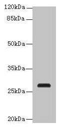 C17orf64 Antibody - Western blot All lanes: C17orf64 antibody at 4µg/ml + Mouse gonadal tissue Secondary Goat polyclonal to rabbit IgG at 1/10000 dilution Predicted band size: 27 kDa Observed band size: 27 kDa