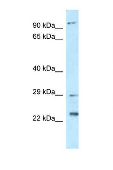 C17orf70 Antibody - C17orf70 antibody Western blot of Placenta lysate. Antibody concentration 1 ug/ml.  This image was taken for the unconjugated form of this product. Other forms have not been tested.
