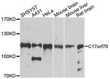 C17orf70 Antibody - Western blot analysis of extracts of various cells.