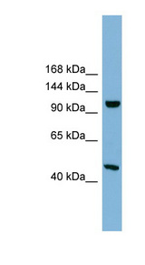 C17orf71 Antibody - C17orf71 antibody Western blot of 721_B cell lysate. This image was taken for the unconjugated form of this product. Other forms have not been tested.