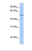 C17orf74 Antibody - Hela cell lysate. Antibody concentration: 1.0 ug/ml. Gel concentration: 12%.  This image was taken for the unconjugated form of this product. Other forms have not been tested.