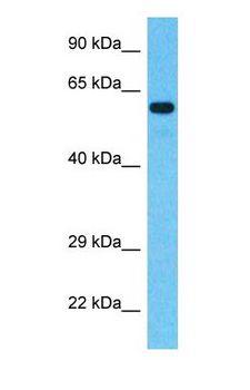 C17orf74 Antibody - Western blot of CQ074 Antibody with human Stomach Tumor lysate.  This image was taken for the unconjugated form of this product. Other forms have not been tested.