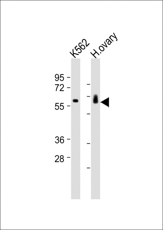 C17orf80 Antibody - All lanes: Anti-C17orf80 Antibody (Center) at 1:1000-1:2000 dilution. Lane 1: K562 whole cell lysates. Lane 2: human ovary lysates Lysates/proteins at 20 ug per lane. Secondary Goat Anti-Rabbit IgG, (H+L), Peroxidase conjugated at 1:10000 dilution. Predicted band size: 67 kDa. Blocking/Dilution buffer: 5% NFDM/TBST.