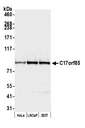 C17orf85 Antibody - Detection of human C17orf85 by western blot. Samples: Whole cell lysate (50 µg) from HeLa, LNCaP, and HEK293T cells prepared using NETN lysis buffer. Antibody: Affinity purified Rabbit anti-C17orf85 antibody used for WB at 1:1000. Secondary: HRP-conjugated goat anti-rabbit IgG (A120-101P). Chemiluminescence with an exposure time of 3 seconds.