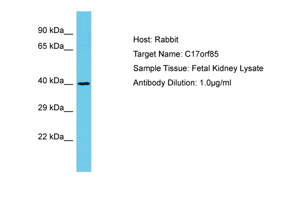 C17orf85 Antibody -  This image was taken for the unconjugated form of this product. Other forms have not been tested.