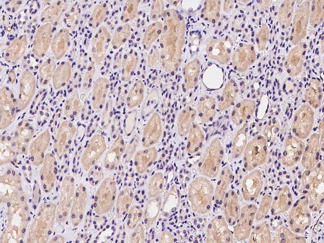 C17orf96 Antibody - Immunochemical staining of human C17orf96 in human kidney with rabbit polyclonal antibody at 1:100 dilution, formalin-fixed paraffin embedded sections.