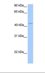 C17orf97 Antibody - Jurkat cell lysate. Antibody concentration: 1.0 ug/ml. Gel concentration: 12%.  This image was taken for the unconjugated form of this product. Other forms have not been tested.