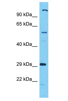 C17orf99 Antibody - C17orf99 antibody Western Blot of HeLa. Antibody dilution: 1 ug/ml.  This image was taken for the unconjugated form of this product. Other forms have not been tested.