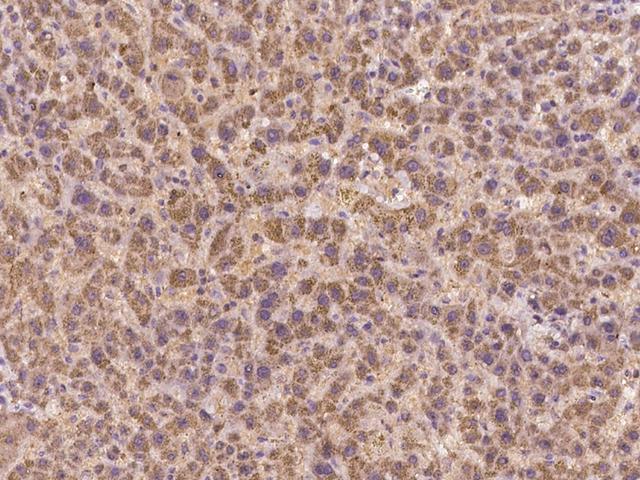 C17orf99 Antibody - Immunochemical staining of human C17orf99 in human liver with rabbit polyclonal antibody at 1:500 dilution, formalin-fixed paraffin embedded sections.