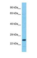 C18orf21 Antibody - Western blot of C18orf21 Antibody with human Fetal Liver lysate.  This image was taken for the unconjugated form of this product. Other forms have not been tested.