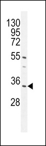 C18orf25 / ARKL1 Antibody - CR025 Antibody western blot of mouse heart tissue lysates (35 ug/lane). The CR025 antibody detected the CR025 protein (arrow).
